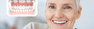 Full Arch Replacement in Romford, Essex | Dental Implants Services | Winning Smiles Dental Clinic