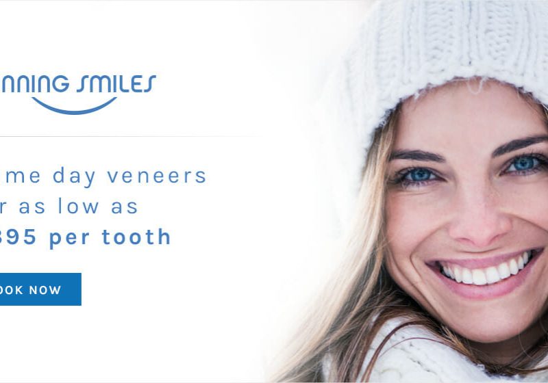 v4_Instant_Veneer_Banner